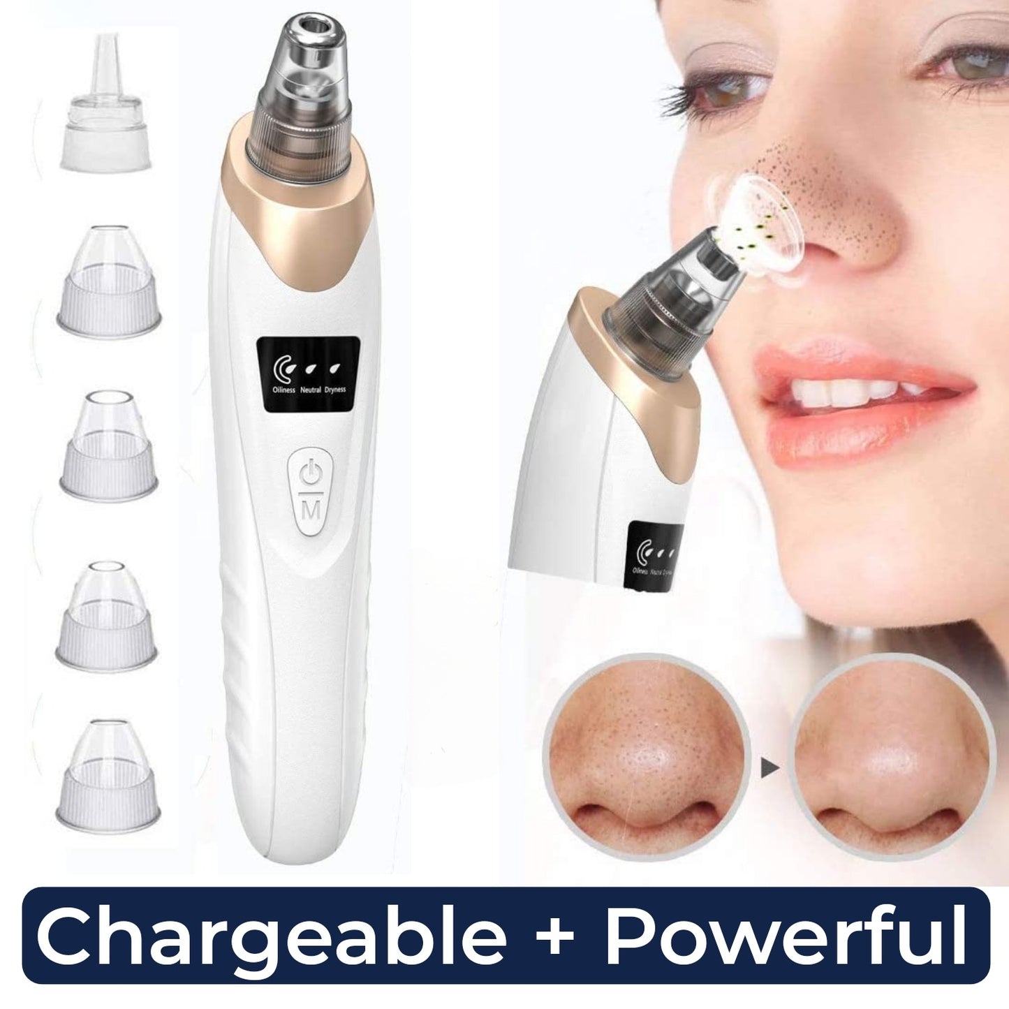 Original 5 in 1 Multi-functional Black Head Removal Derma Suction Machine Blackhead Remover