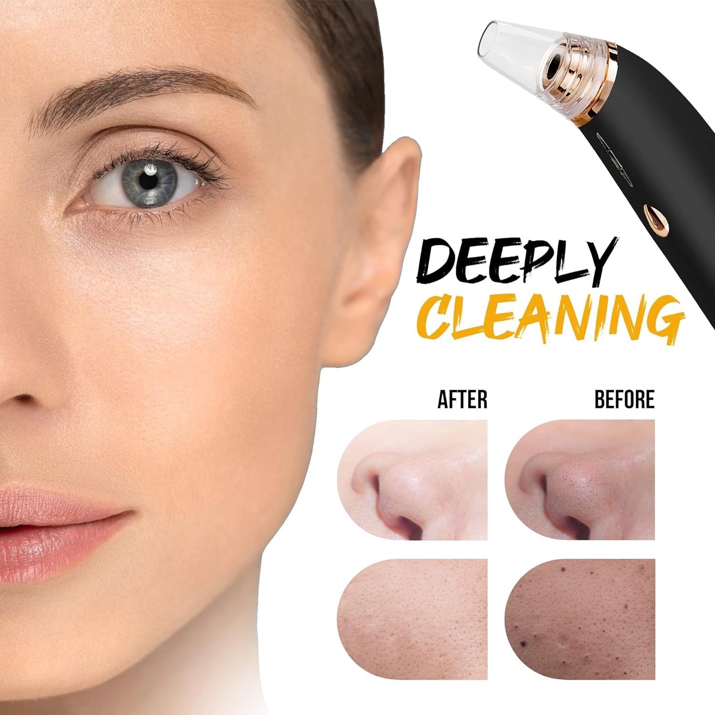 Original 5 in 1 Multi-functional Black Head Removal Derma Suction Machine Blackhead Remover